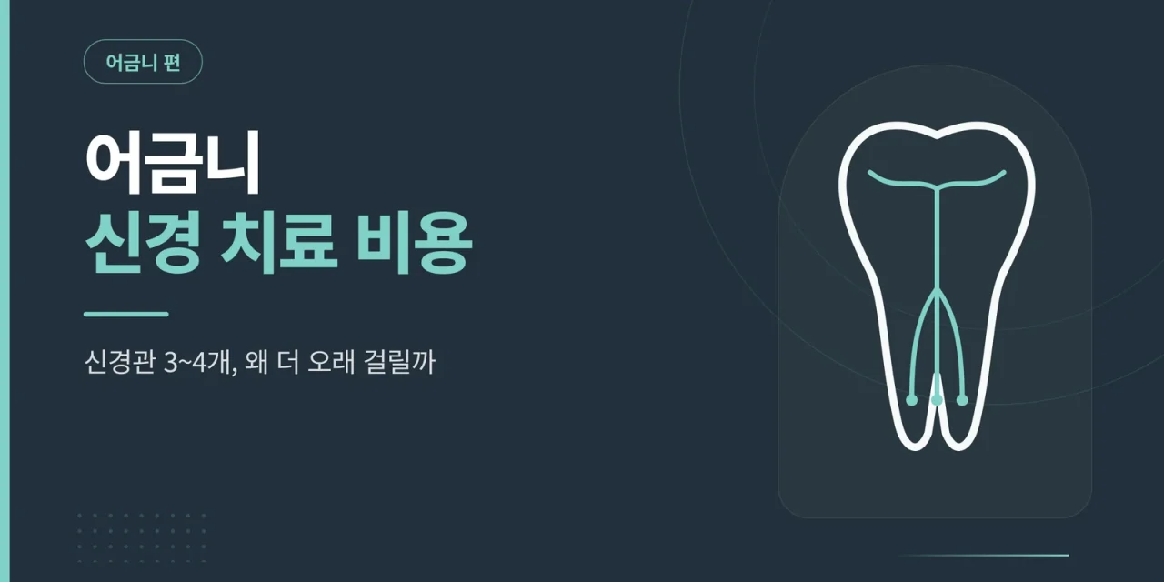 어금니 신경 치료 비용